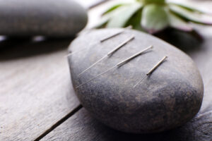 Acupuncture for side effect management during breast cancer treatment